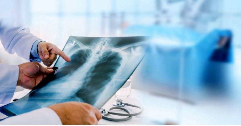 google x ray ai medic | Technea.gr - Χρήσιμα νέα τεχνολογίας