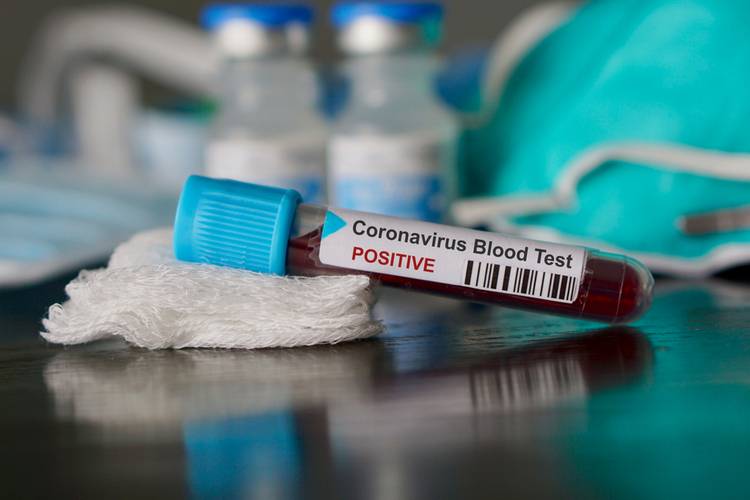 Coronavirus shutterstock website1 | Technea.gr - Χρήσιμα νέα τεχνολογίας